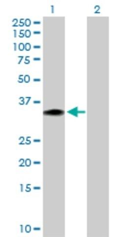 Anti-FGF21 antibody produced in rabbit