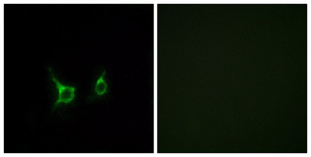 Anti-FFAR2 antibody produced in rabbit