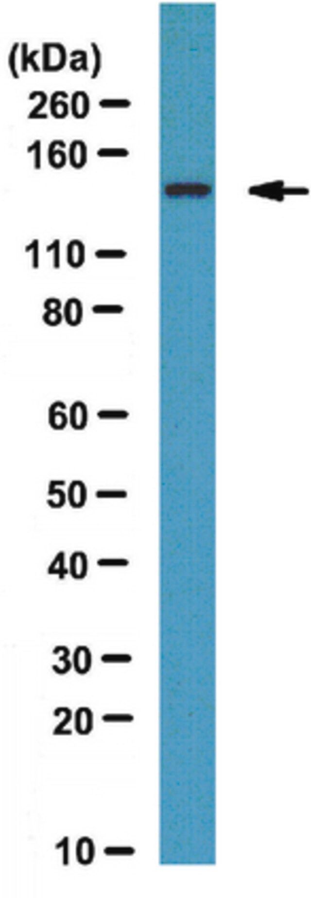 Anti-FHOD1 Antibody