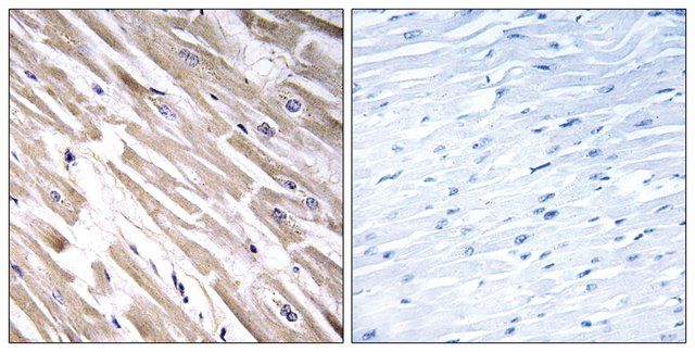 Anti-FGF18 antibody produced in rabbit