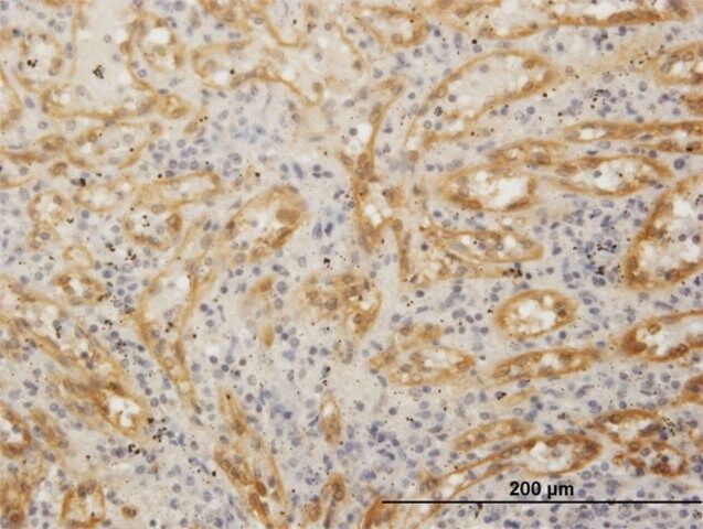 Anti-FHOD1 antibody produced in mouse