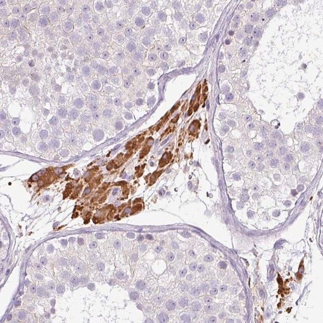 Anti-FGF17 antibody produced in rabbit