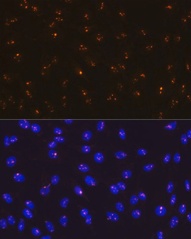 Anti-Fibrillarin/U3 RNP antibody produced in rabbit