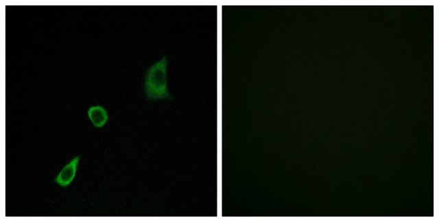 Anti-FGF23 antibody produced in rabbit