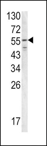 ANTI-FIBB(N-TERMINAL) antibody produced in rabbit