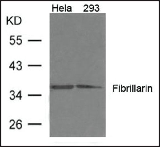 Anti-Fibrillarin antibody produced in rabbit