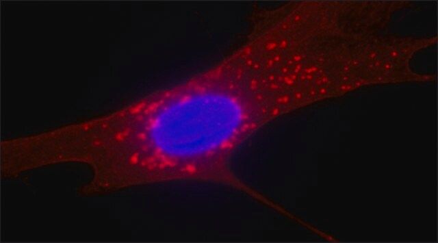 Anti-Fibroblast Surface Protein antibody, Mouse monoclonal