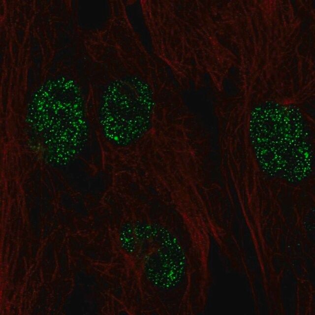 Anti-FICD antibody produced in rabbit