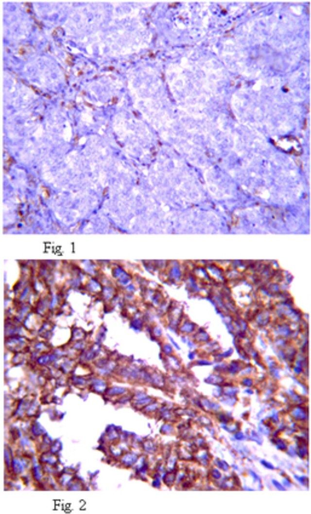 Anti-Fibrillin-2 Antibody, clone 48