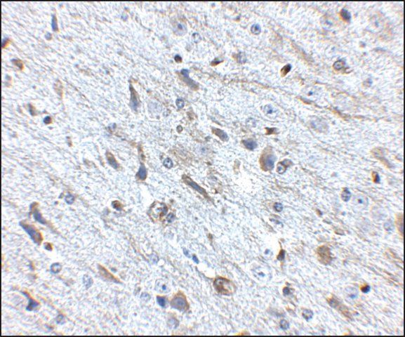 Anti-FKBP15 antibody produced in rabbit