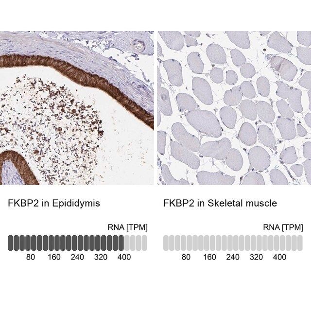 Anti-FKBP2 antibody produced in rabbit