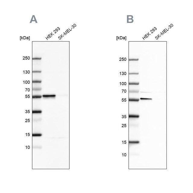 Anti-FKBP5 antibody produced in rabbit