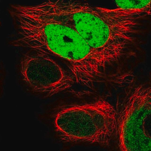 Anti-FKBPL antibody produced in rabbit