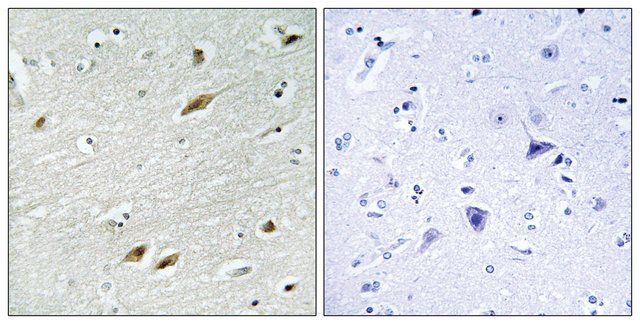 Anti-FKHR antibody produced in rabbit