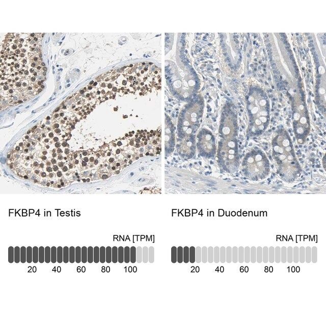 Anti-FKBP4 antibody produced in rabbit