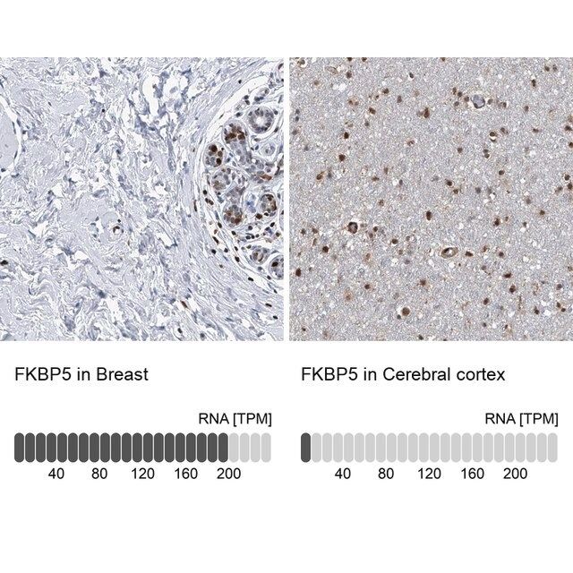 Anti-FKBP5 antibody produced in rabbit