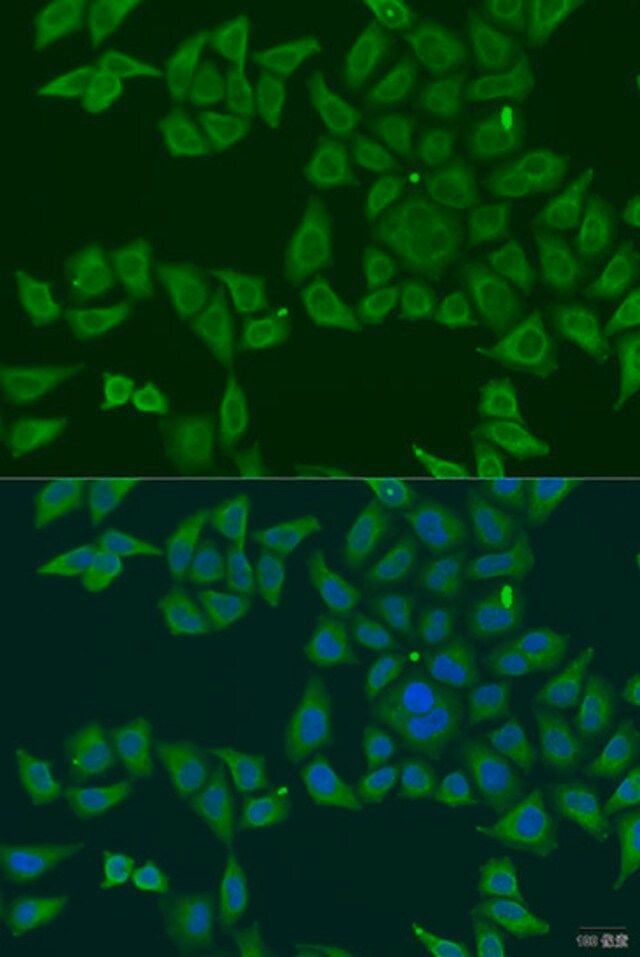 Anti-FKBP2 antibody produced in rabbit