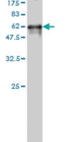 ANTI-FLJ20643 antibody produced in mouse