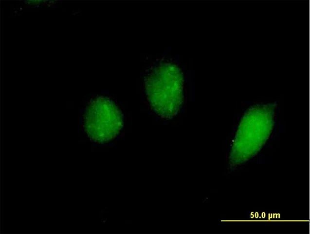 Anti-FKHL18 antibody produced in mouse