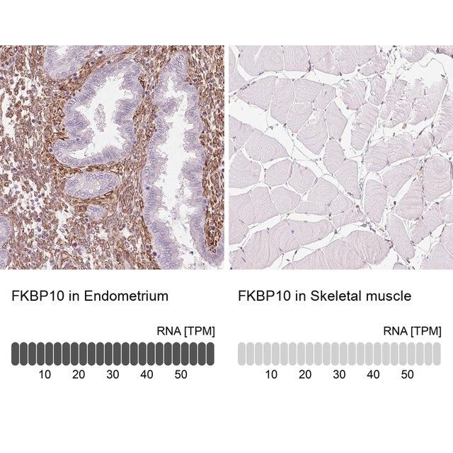 Anti-FKBP10 antibody produced in rabbit