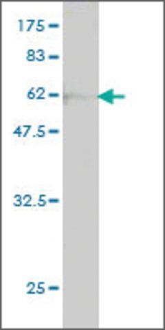 ANTI-FLJ20643 antibody produced in mouse