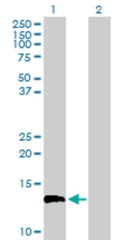 Anti-FLJ39155 antibody produced in mouse