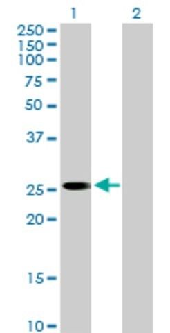 Anti-FLJ22662 antibody produced in mouse