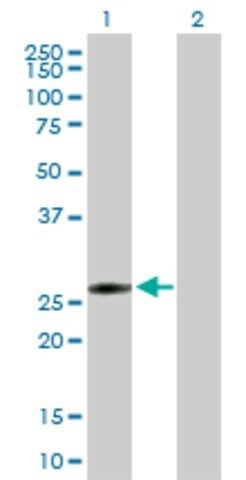 Anti-FLJ40504 antibody produced in mouse