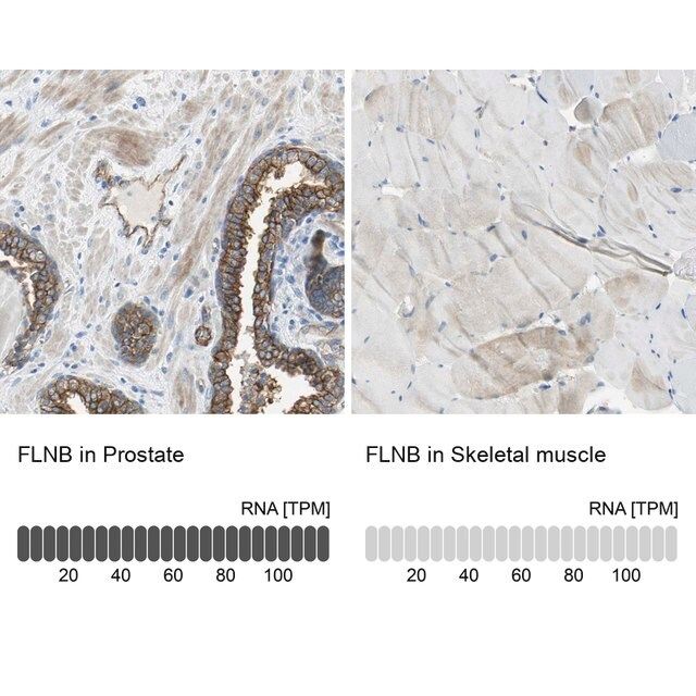 Anti-FLNB antibody produced in rabbit