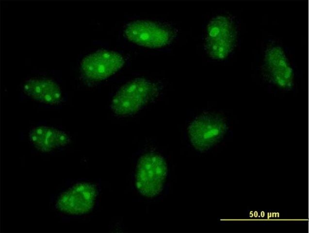 Anti-FLJ11184 antibody produced in mouse