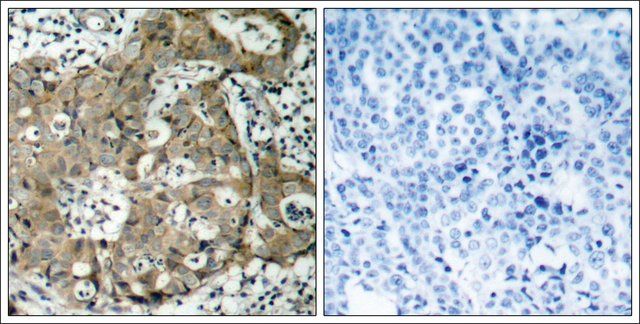 Anti-FOXO1 (Ab-319) antibody produced in rabbit