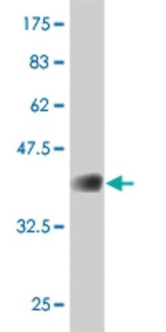 ANTI-FOXO1A antibody produced in mouse