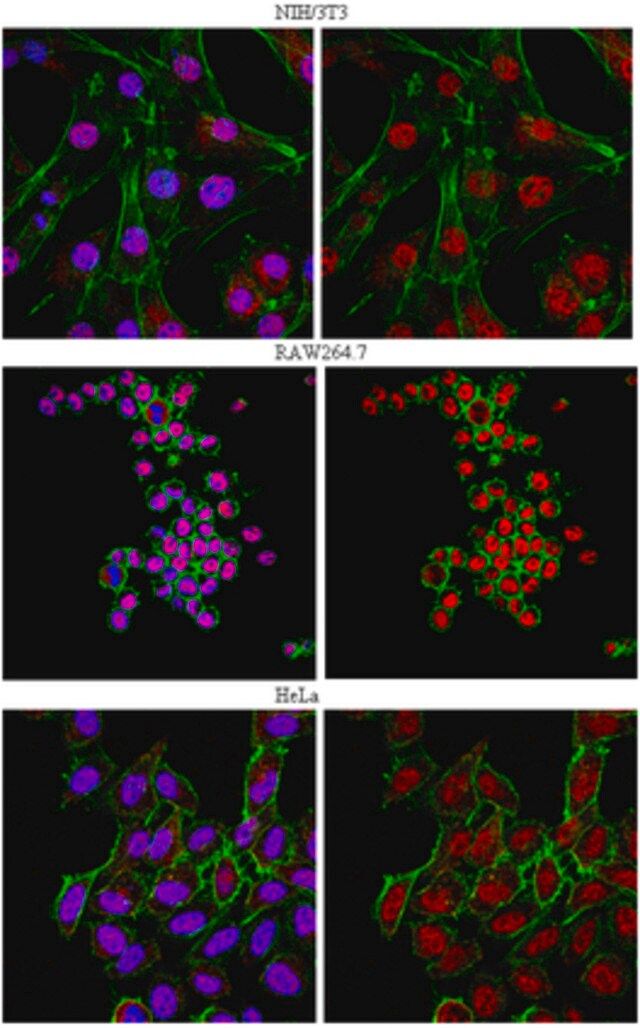 Anti-FoxP1 Antibody