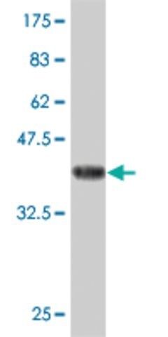 ANTI-FOXO1A antibody produced in mouse