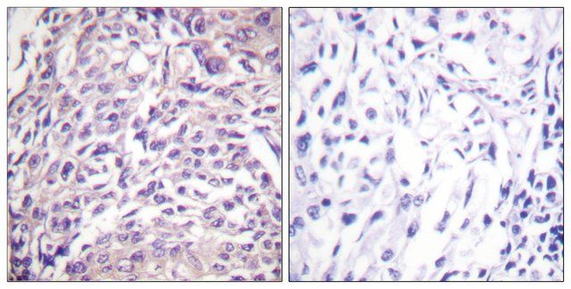 Anti-FOXO1A antibody produced in rabbit