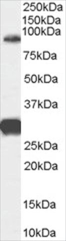 Anti-FOXP2 (Internal) antibody produced in goat