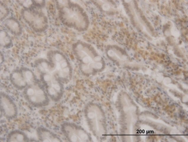 ANTI-FOXO3A antibody produced in mouse