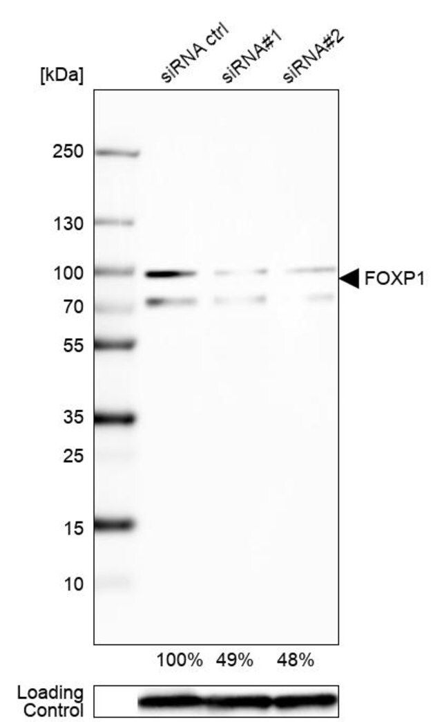 Anti-FOXP1 antibody produced in rabbit