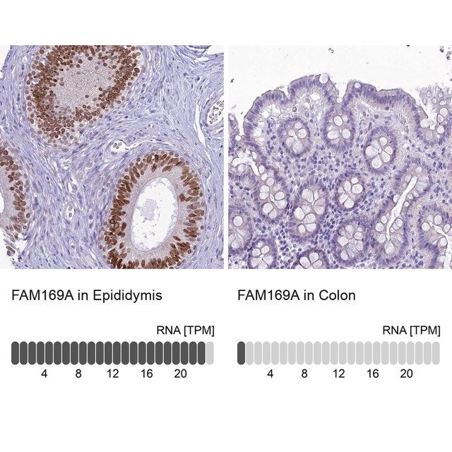 Anti-FAM169A antibody produced in rabbit