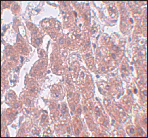 Anti-FAM59A antibody produced in rabbit