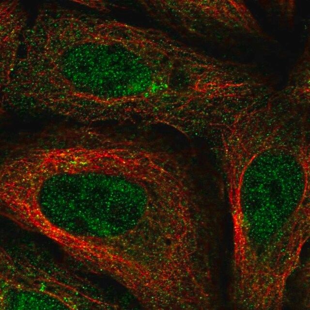 Anti-FAM114A1 antibody produced in rabbit