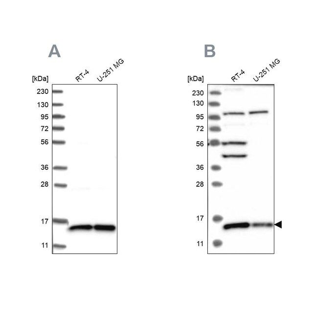 Anti-FAM136A antibody produced in rabbit