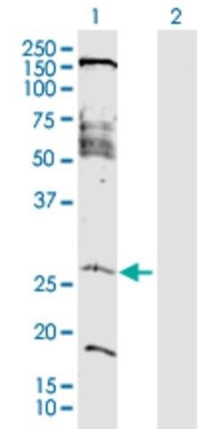 Anti-FAM177A1 antibody produced in rabbit