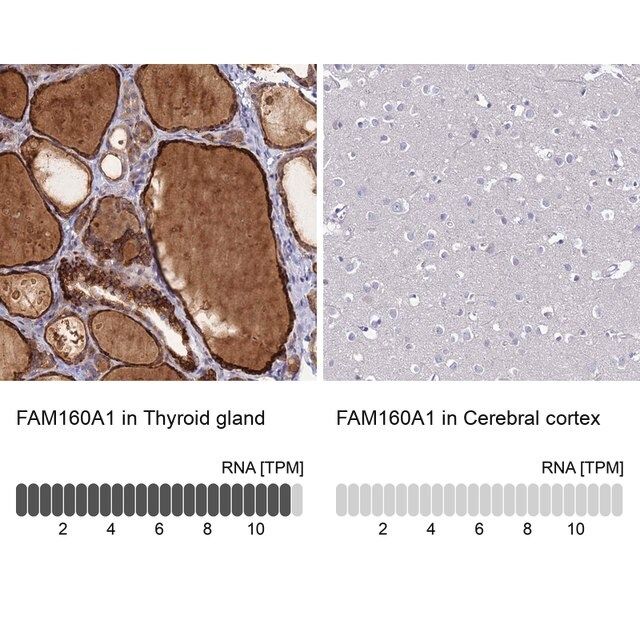 Anti-FAM160A1 antibody produced in rabbit