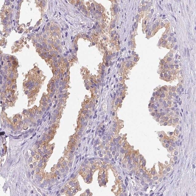 Anti-FAM177A1 antibody produced in rabbit