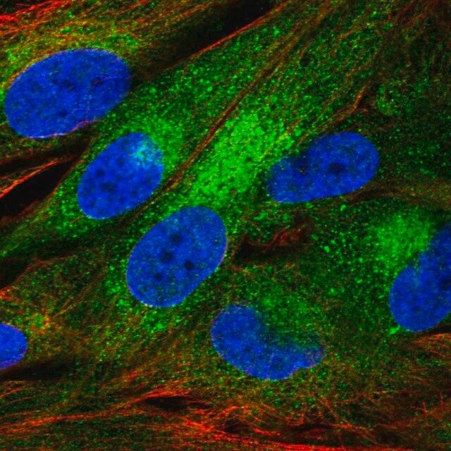 Anti-FAM114A1 antibody produced in rabbit