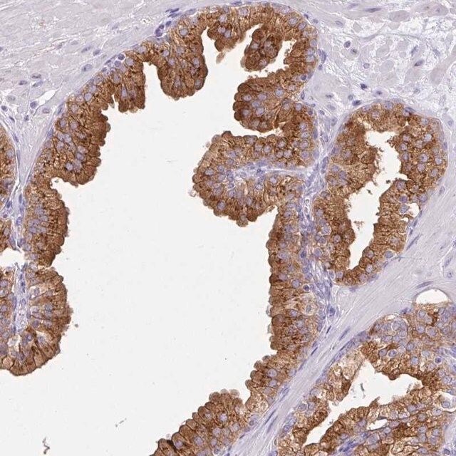 Anti-FAM177A1 antibody produced in rabbit