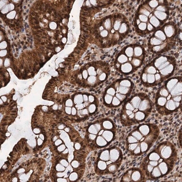 Anti-FAM216B antibody produced in rabbit