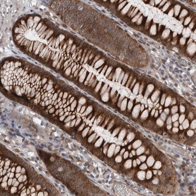 Anti-FAM102B antibody produced in rabbit