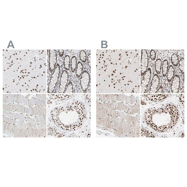 Anti-FAM98B antibody produced in rabbit